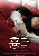 흉터